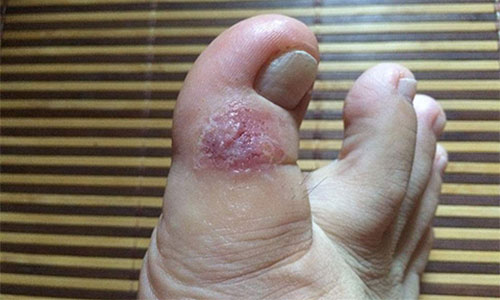 ˮ���ͽ�����ô���� ˮ���ͽ���ע������